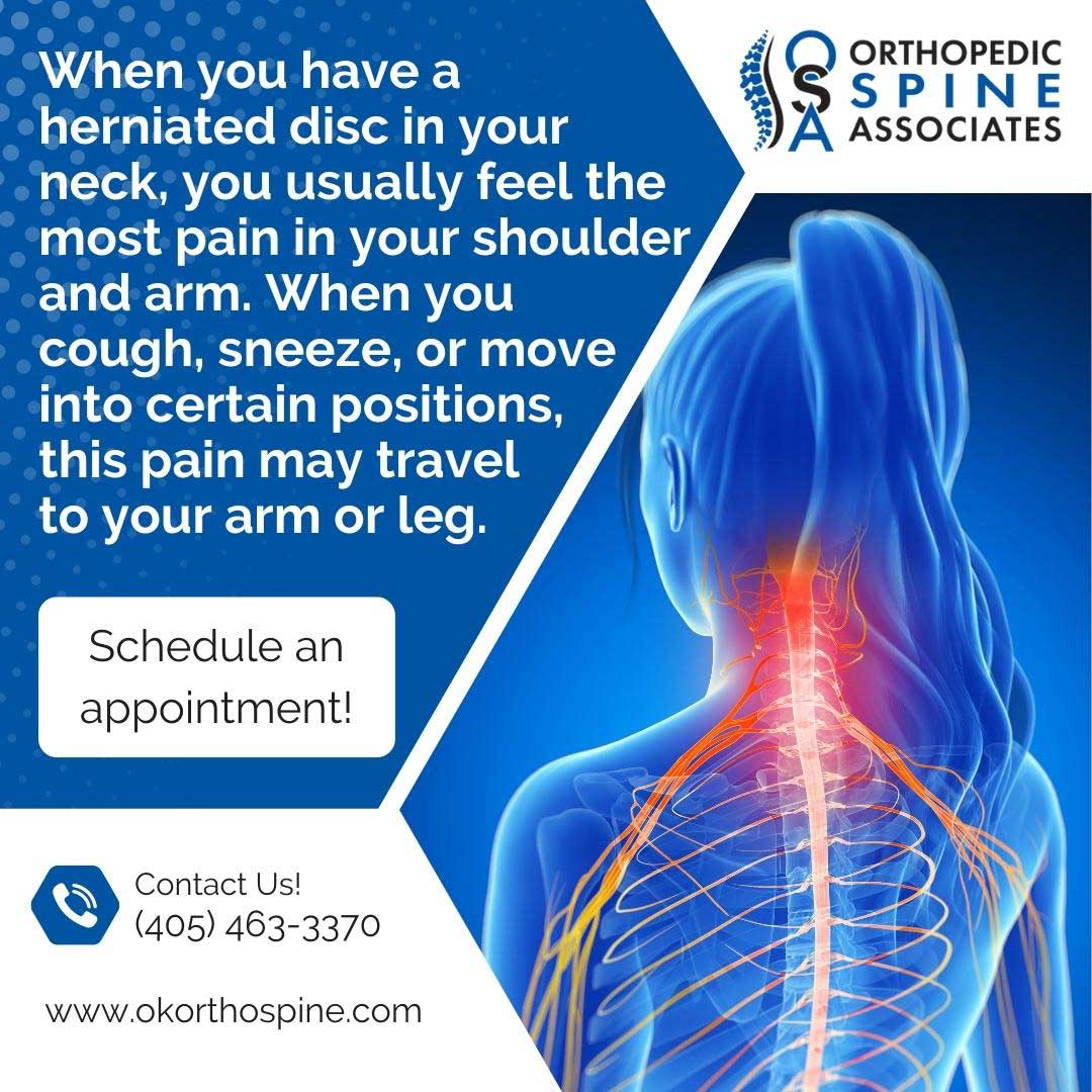 Herniated Disc In Neck